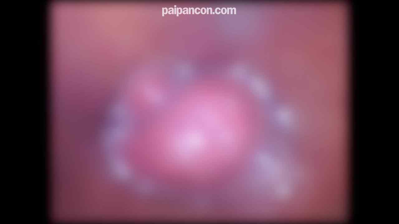 FC2-PPV-4830290 - ♀198 よつはちゃん続編。田舎から出てきたよつはちゃんとの楽しかったデートと中出しセックス。★特典で顔出しと無修正と膣内カメラ thumbnail_9.jpg